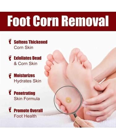 Feet Corn Removal Serum 30ml ( Pack Of 1 )